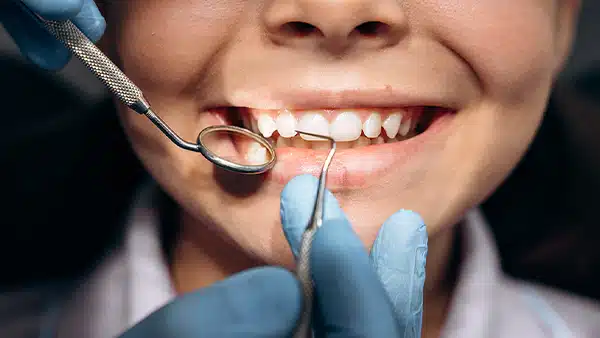 Odontopediatría en Clínica Dental Horta