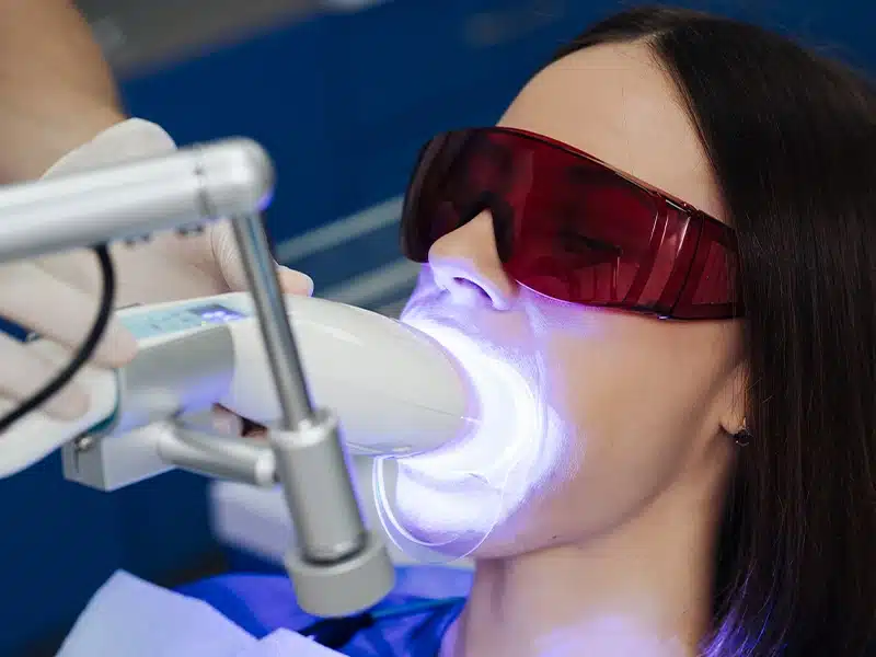 blanqueamiento dental con luz led